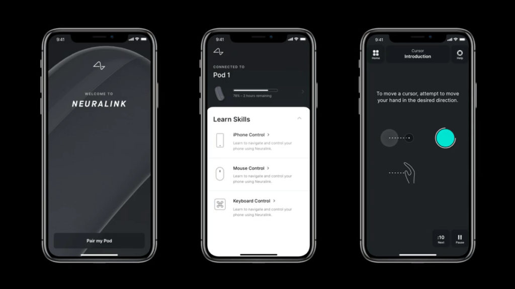 neuralink-app-ios